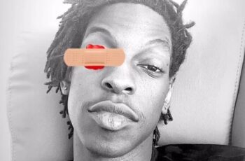 YunLilo (Twenty20) – AAAH (feat. Mimofukk) [Baixar 2024]