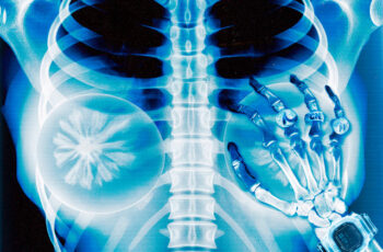 Arthurzim – PEITO FALSO (feat. Mc Rodrigo do CN, WIU & OLIE) (TRAP) 2025